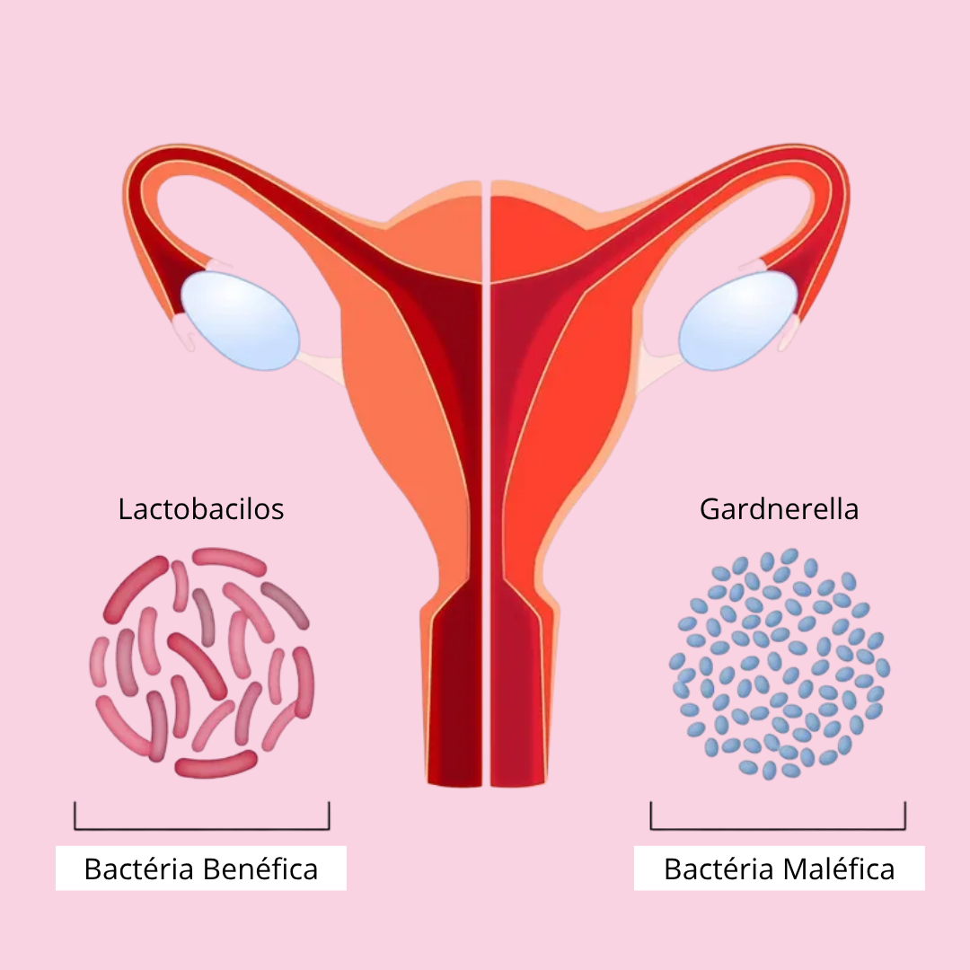 Como restaurar o equilíbrio da flora vaginal naturalmente