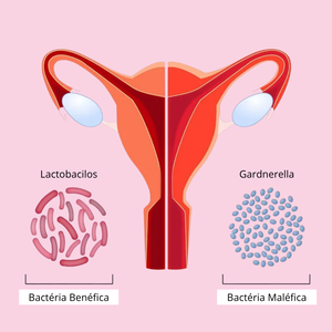 Como restaurar o equilíbrio da flora vaginal naturalmente
